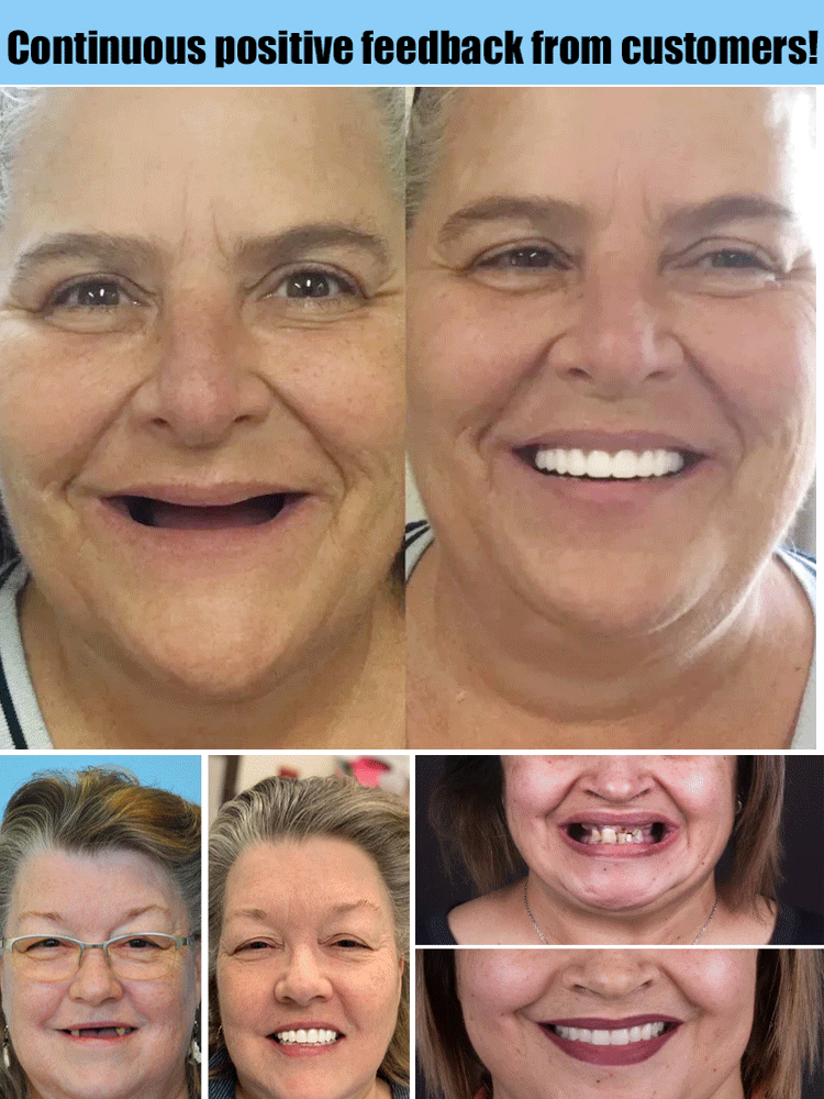 Flexible Denture Set for Upper & Lower Jaw – Reusable & Custom-Fit