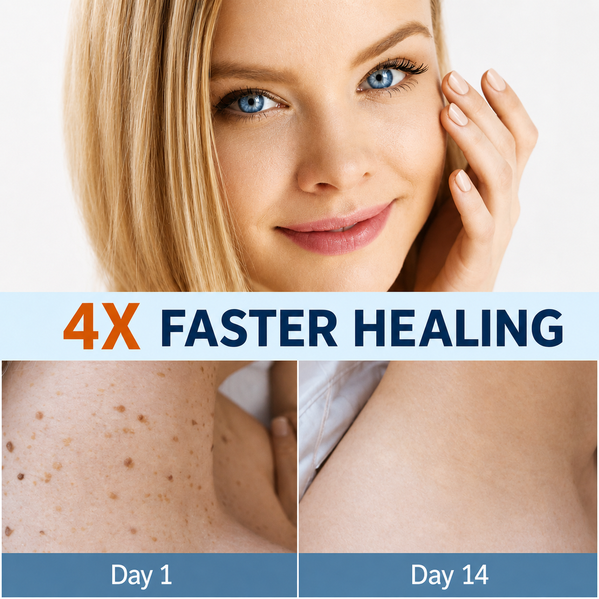 Skin Tag Remover Patches | Painless Gentle Skin Tag Removal Patch 3
